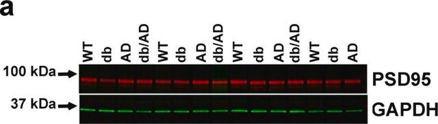 Anti-(saures) Gliafilamentprotein in Kaninchen hergestellte Antikörper IgG fraction of antiserum, buffered aqueous solution