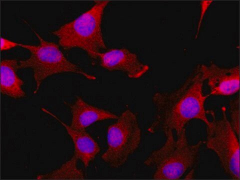 Anti-GLUT4 (C-terminal) antibody produced in rabbit ~1.5&#160;mg/mL, affinity isolated antibody, buffered aqueous solution