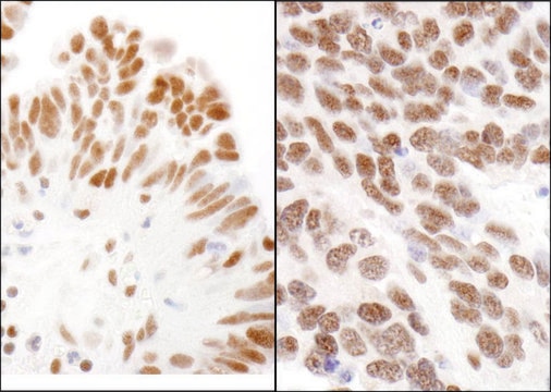 Rabbit anti-CBX3 Antibody, Affinity Purified Powered by Bethyl Laboratories, Inc.