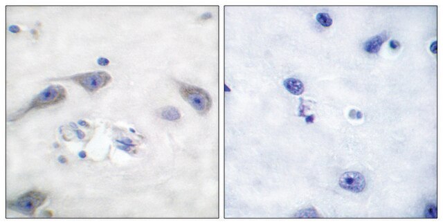 Anti-DARPP-32 antibody produced in rabbit affinity isolated antibody