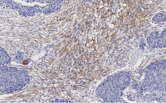 Anti-Zyxin Antibody, clone 2F17 ZooMAb&#174; Rabbit Monoclonal recombinant, expressed in HEK 293 cells