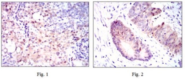 Anti-ASS1 Antibody, clone 2C10 clone 2C10, from mouse