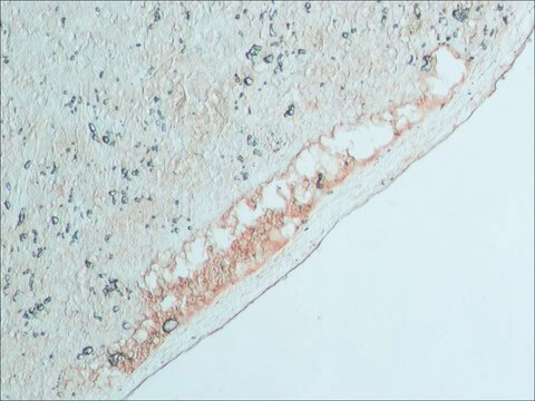 Anti-Bovine IgG (whole molecule)&#8722;Peroxidase antibody produced in rabbit IgG fraction of antiserum, buffered aqueous solution