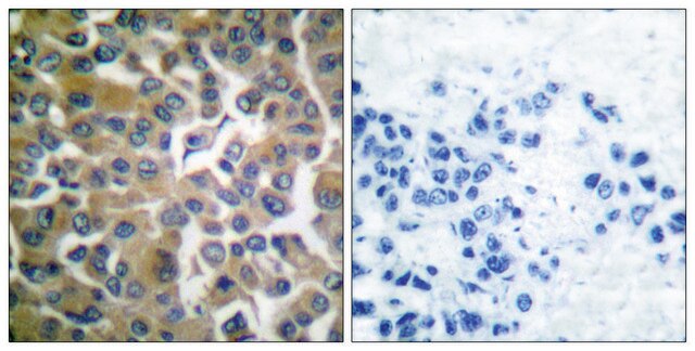 Anti-FAP-1 antibody produced in rabbit affinity isolated antibody