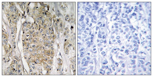 Anti-HER2 antibody produced in rabbit affinity isolated antibody