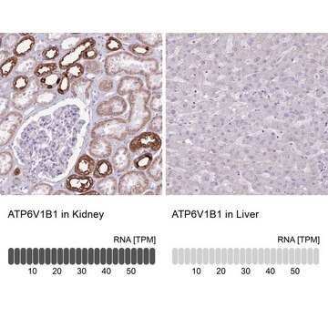 Anti-ATP6V1B1 antibody produced in rabbit Prestige Antibodies&#174; Powered by Atlas Antibodies, affinity isolated antibody, buffered aqueous glycerol solution