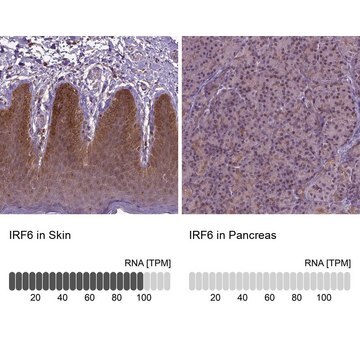 Anti-IRF6 antibody produced in rabbit Prestige Antibodies&#174; Powered by Atlas Antibodies, affinity isolated antibody, buffered aqueous glycerol solution