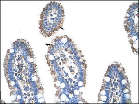 Anti-SLC22A1 (AB1) antibody produced in rabbit IgG fraction of antiserum