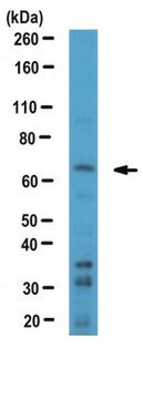 Anti-TFE3-Antikörper from rabbit, purified by affinity chromatography