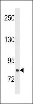 ANTI-SLCO1B3(C-TERMINAL) antibody produced in rabbit affinity isolated antibody, buffered aqueous solution