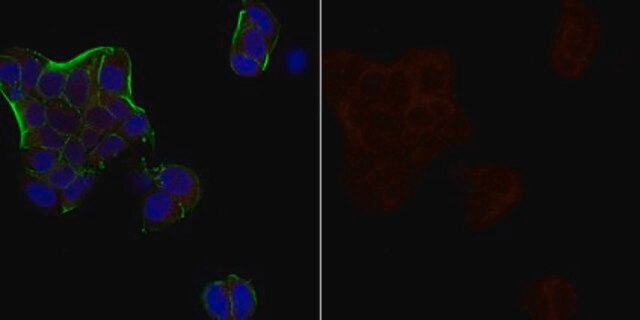 Anti-Androgen Receptor Antibody, Alexa Fluor&#8482; 647 Conjugate from rabbit, ALEXA FLUOR&#8482; 647