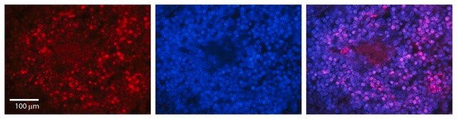 Anti-PARP1 antibody produced in rabbit IgG fraction of antiserum