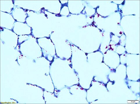 Acid Fast TISSUE-TROL&#8482; Control Slides mouse lung tissue containing Mycobacterium gordonae