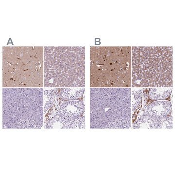 Anti-APOE antibody produced in rabbit Prestige Antibodies&#174; Powered by Atlas Antibodies, affinity isolated antibody, buffered aqueous glycerol solution