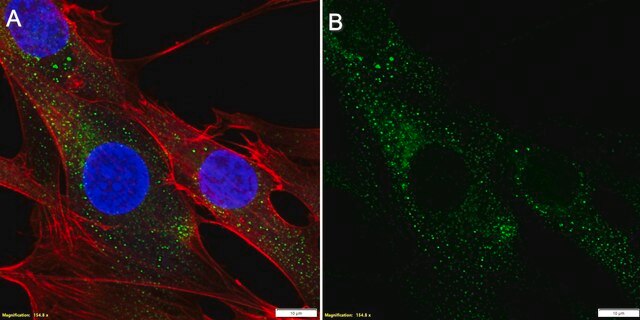 Anti-AGTR1 Antibody, clone 1I12 ZooMAb&#174; Rabbit Monoclonal recombinant, expressed in HEK 293 cells