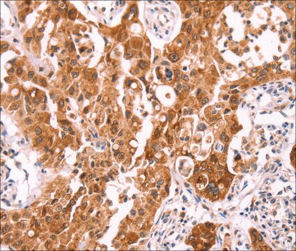 Anti-NCEH1 antibody produced in rabbit affinity isolated antibody