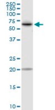 Anti-TKT antibody produced in rabbit purified immunoglobulin, buffered aqueous solution