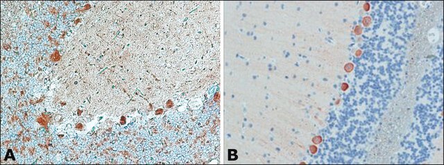 Anti-Myosin Va (LF-18) antibody produced in rabbit ~0.4&#160;mg/mL, affinity isolated antibody, buffered aqueous solution