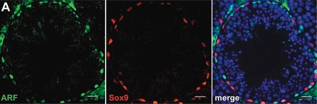 Anti-Sox9-Antikörper Chemicon&#174;, from rabbit