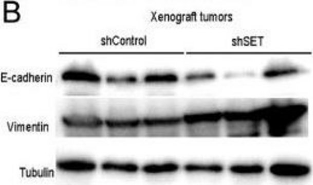 Anti-Vimentin antibody, Mouse monoclonal clone V9, purified from hybridoma cell culture