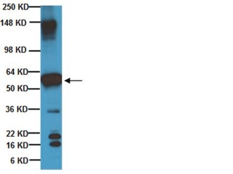 Anti-Beta-III-Tubulin-Antikörper Chemicon&#174;, from chicken