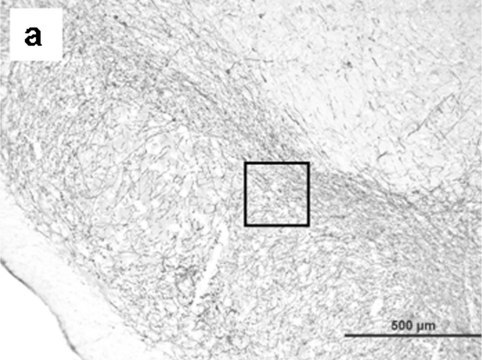 Anti-Tyrosine Hydroxylase Antibody Chemicon&#174;, from rabbit