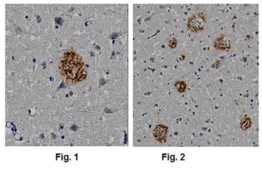 Anti-Amyloid &#946;A4, clone 1E8 (Amino Terminus) Antibody clone 1E8, 1&#160;mg/mL, from mouse