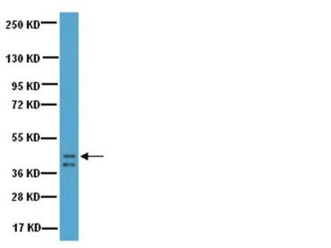 Anti-Growth Associated Protein-43 (GAP-43) Antibody Chemicon&#174;, from rabbit