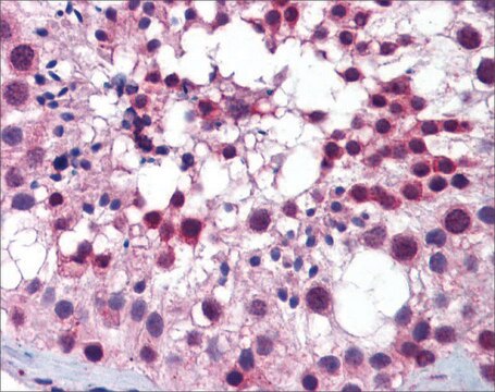 Anti-PLK1 affinity isolated antibody