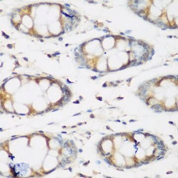 Anti-BMP2 antibody produced in rabbit