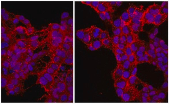 Anti-NG2 Chondroitin Sulfate Proteoglycan, Cy3 Conjugate Antibody from rabbit, CY3 conjugate