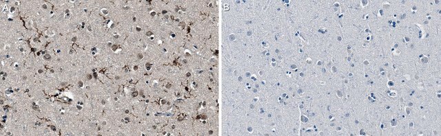 Anti-P2RY12 Antibody, clone 10B5.3.27