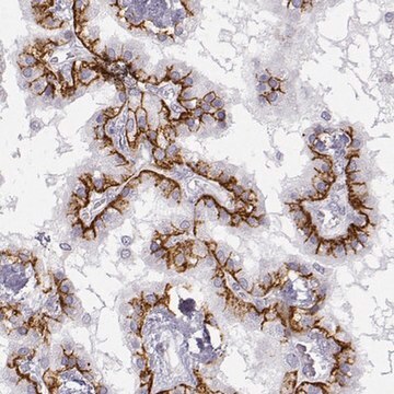 Anti-LEPR antibody produced in rabbit Prestige Antibodies&#174; Powered by Atlas Antibodies, affinity isolated antibody, buffered aqueous glycerol solution