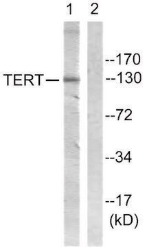 Anti-Telomerase antibody produced in rabbit affinity isolated antibody