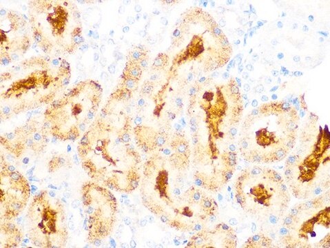 Anti-GCLC antibody produced in rabbit