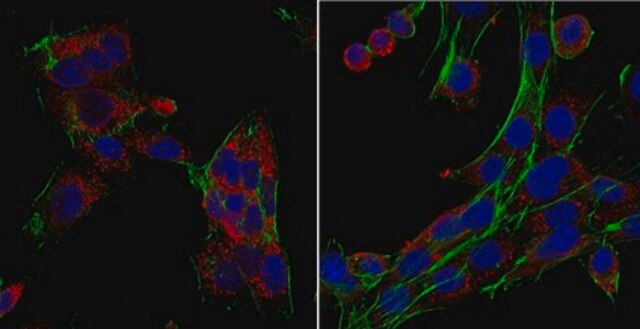 Anti-Laminin-Rezeptor-Antikörper from rabbit, purified by affinity chromatography