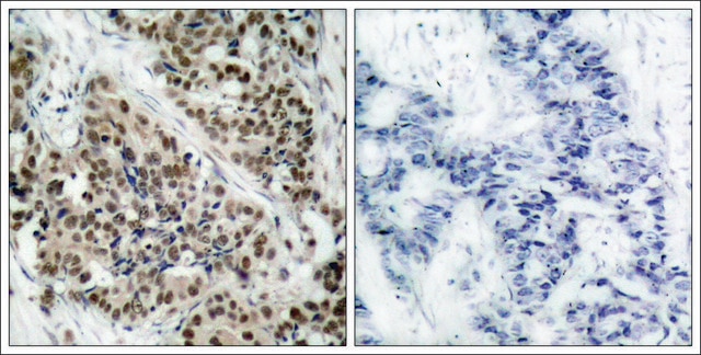 Anti-phospho-FOXO1 (pSer256) antibody produced in rabbit affinity isolated antibody