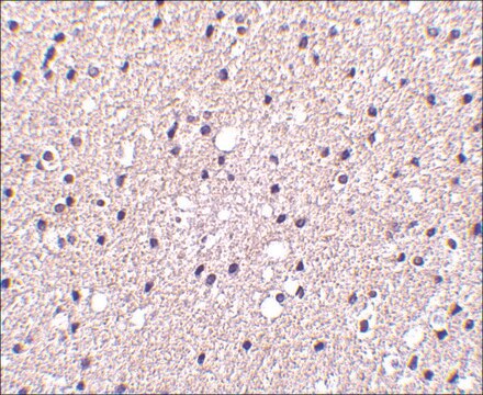 Anti-Presenilin1 antibody produced in rabbit affinity isolated antibody, buffered aqueous solution