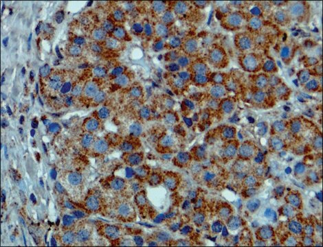 Anti-BRAF (V600E) antibody, Rabbit monoclonal recombinant, expressed in HEK 293 cells, clone RM8, purified immunoglobulin