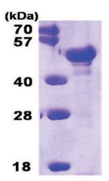 Pentraxin 3 human recombinant, expressed in E. coli, &#8805;90% (SDS-PAGE)