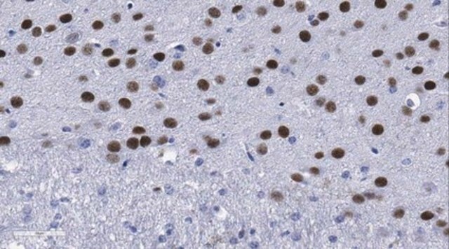 Anti-CTIP2/BCL11B-Antikörper, Klon&nbsp;25B6 clone 25B6, from rat