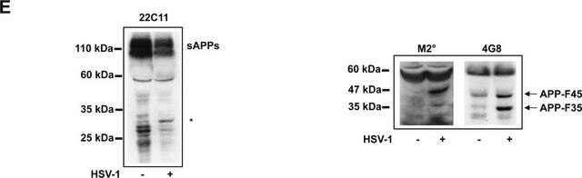 Anti-APP A4 Antibody, a.a. 66-81 of APP {NT}, clone 22C11 clone 22C11, Chemicon&#174;, from mouse