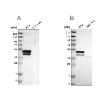 Anti-KRT23 antibody produced in rabbit Prestige Antibodies&#174; Powered by Atlas Antibodies, affinity isolated antibody, buffered aqueous glycerol solution