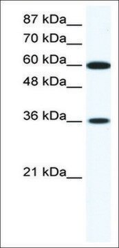 Anti-FOXF1 (AB1) antibody produced in rabbit IgG fraction of antiserum