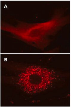 LentiBrite RFP-LC3 Lentiviral Biosensor