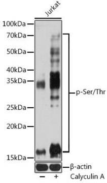 Anti-pan Phospho-Serine/Threonine antibody produced in mouse