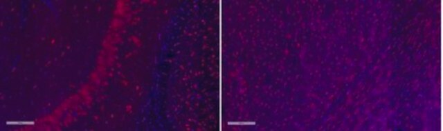 Anti-Tau Antibody, clone PC1C6, Alexa Fluor&#8482; 555 Conjugate clone PC1C6, from mouse, ALEXA FLUOR&#8482; 555