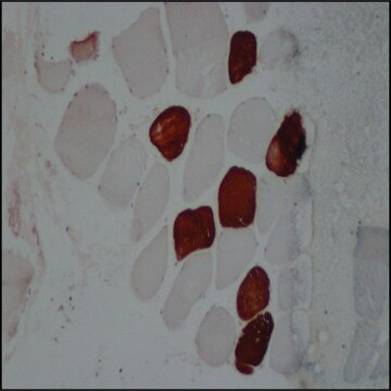 Anti-Myosin (Skeletal, Slow) antibody, Mouse monoclonal clone NOQ7.5.4D, purified from hybridoma cell culture