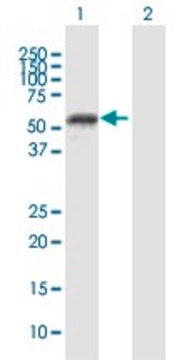 Anti-MMP1 antibody produced in mouse purified immunoglobulin, buffered aqueous solution