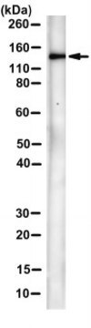 Anti-MLK1/MRTF-A Antibody, clone 1A11